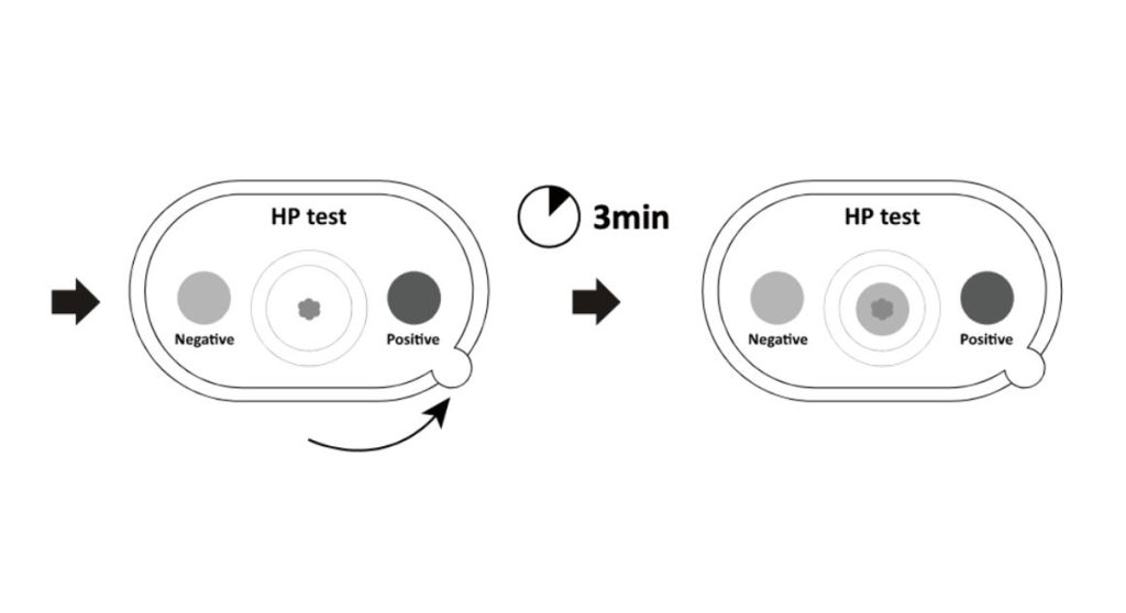 Interpretation of results for H. pylori (Tartar) Rapid Screening Test