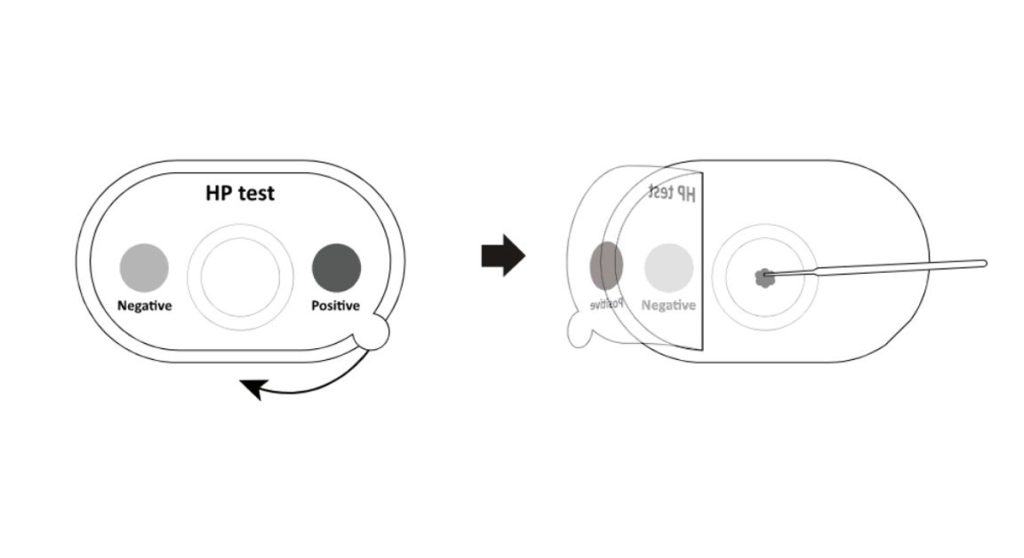How to do the H. pylori (Tartar) Rapid Screening Test