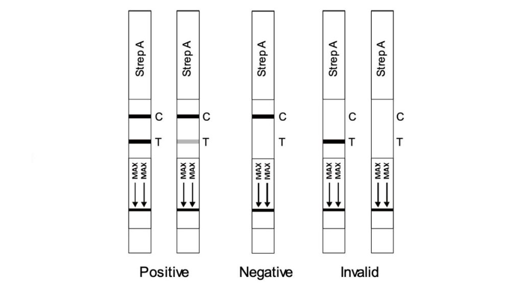 how to do the Strep A Rapid Throat Test - interpretation of results
